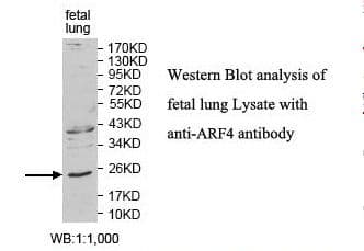 IHC-plus™ Polyclonal Rabbit anti-Human ARF4 Antibody (aa2-180, IHC, WB)