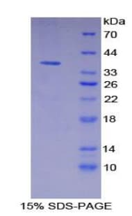 Mouse FLT4 / VEGFR3 Protein (Recombinant His)