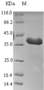Mouse THRSP Protein (Recombinant 6His-SUMO, N-terminus)