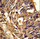 Polyclonal Rabbit anti-Human ETFDH Antibody (aa32-61, IHC, WB)