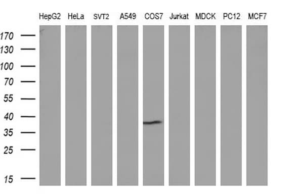 Monoclonal Mouse anti-Human NR0B2 Antibody (clone OTI1A2, WB)