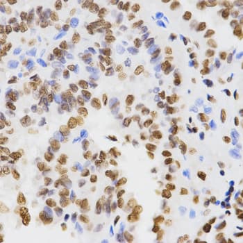 Histone H3 Antibody (Di-Methyl-Lys9)