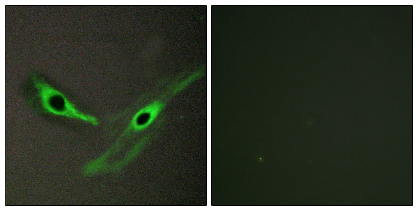 ICK Antibody (aa241-290)