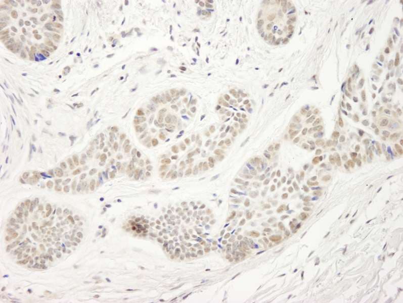 UHRF1 Antibody (aa275-325)