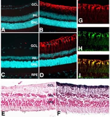IHC-plus™ GLUL / Glutamine Synthetase Antibody