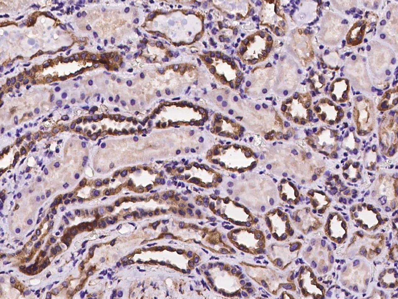 Polyclonal Rabbit anti-Human STC2 / Stanniocalcin 2 Antibody (IHC)