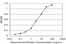PSPH Antibody (clone 3A5)