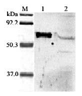 Polyclonal Rabbit anti-Human ARP5 / ANGPTL6 Antibody (aa114-130, WB)