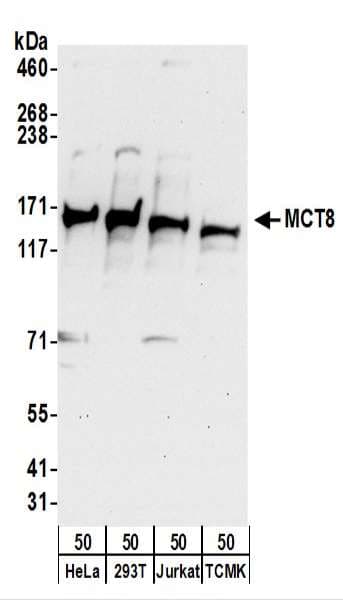 SLC16A2 / MCT8 Antibody (aa250-300)