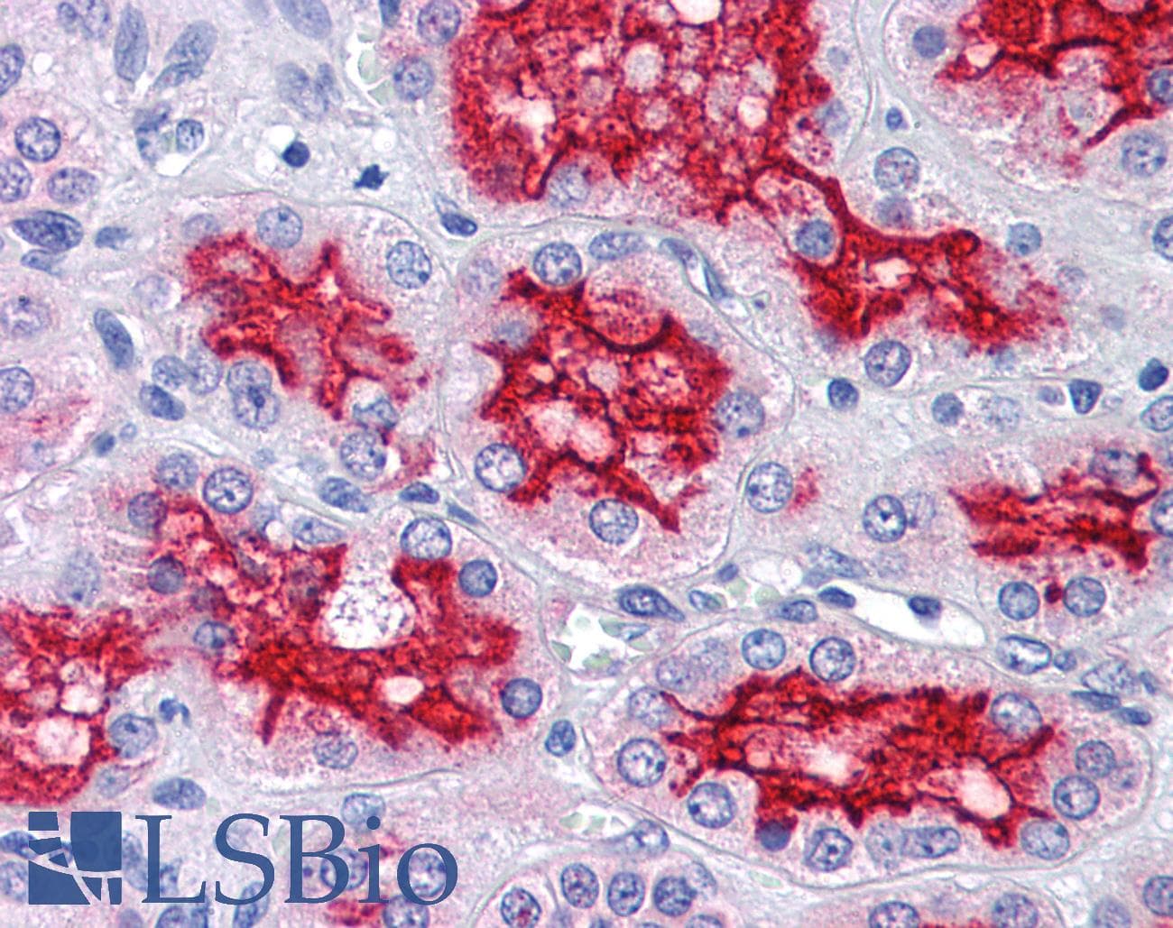 IHC-plus™ PRDX4 / Peroxiredoxin 4 Antibody (clone 2C12)