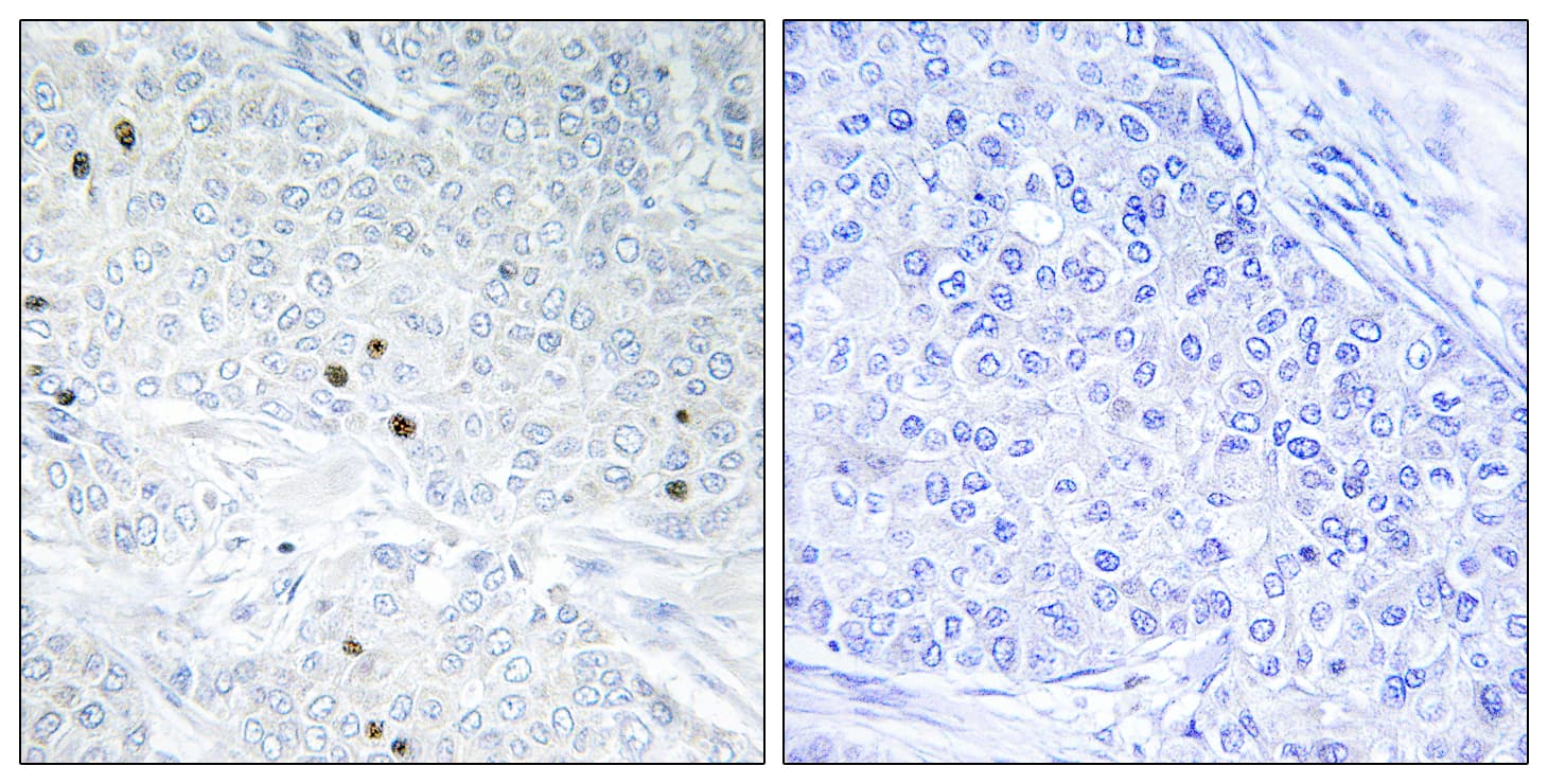 TP53INP2 Antibody (aa1-50)