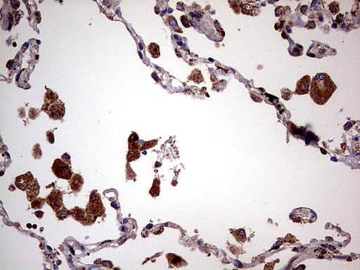 Monoclonal Mouse anti-Human PDSS2 / DLP1 Antibody (clone UMAB177, IHC, WB)