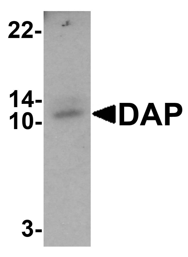 IHC-plus™ Polyclonal Rabbit anti-Human DAP Antibody (IHC, IF, WB)