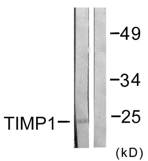 TIMP1 Antibody
