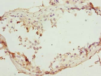 Polyclonal Rabbit anti-Human SUPT4H1 / SPT4 Antibody (IHC)