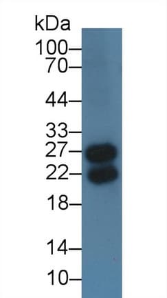 IGLL1 / CD179b Antibody (aa29-201)