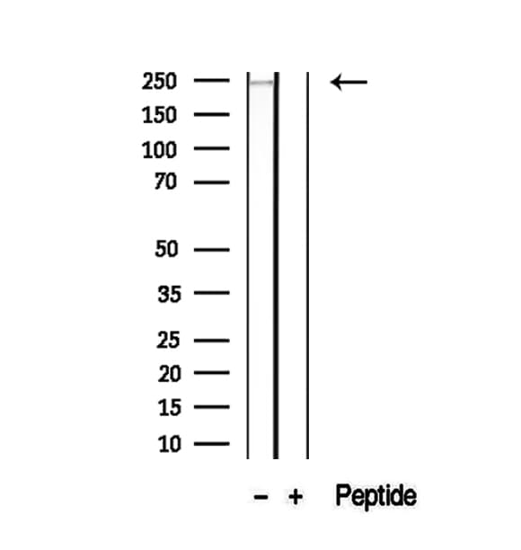 MYHC / MYH6 Antibody