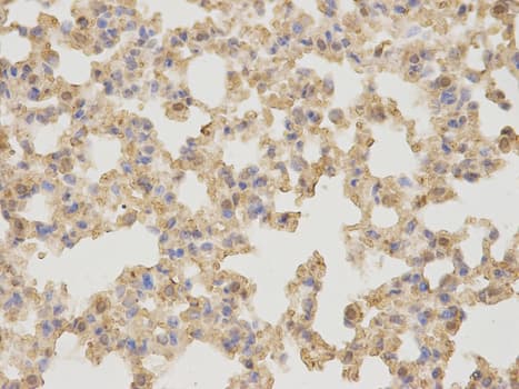 IHC-plus™ Polyclonal Rabbit anti-Human AMBP Antibody (IHC, WB)