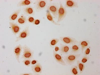 Polyclonal Rabbit anti-Human HIST1H3A Antibody (IHC, IF, WB)