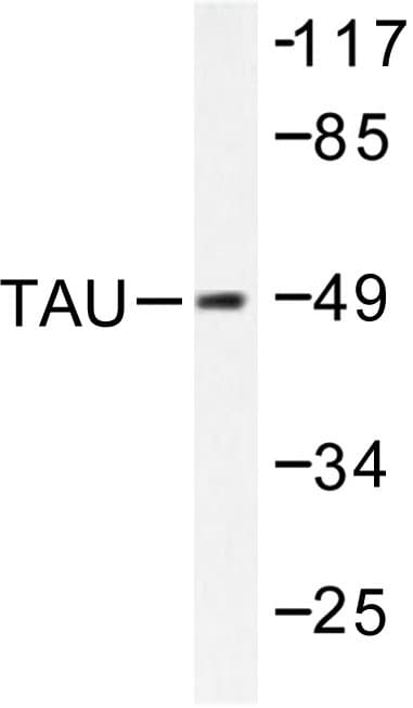 MAPT / Tau Antibody (Lys225)