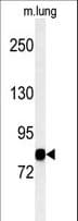 MAP3K11 / MLK3 Antibody