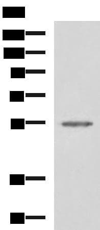 SLC16A1 / MCT1 Antibody