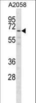 Polyclonal Rabbit anti-Human GPKOW Antibody (aa309-338, WB)