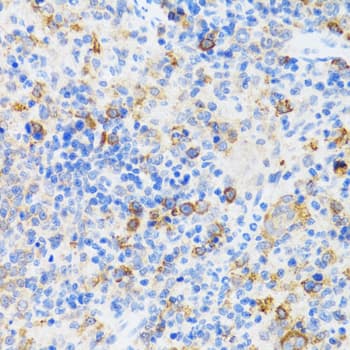 CHAF1B / CAF1 Antibody