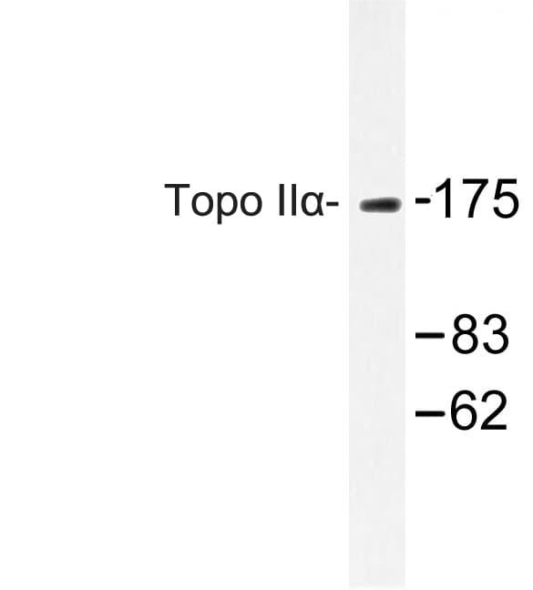 Polyclonal Rabbit anti-Human TOP2A / Topoisomerase II Alpha Antibody (Gln14, IHC, IF, WB)