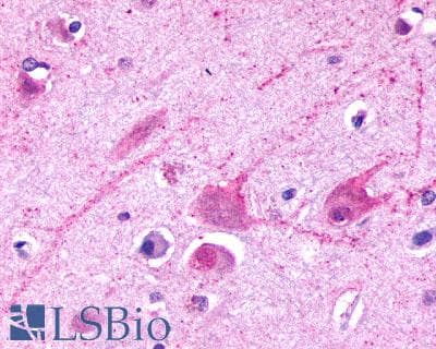 PathPlus™ GRM2 / MGLUR2 Antibody (N-Terminus)