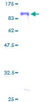 Human UBXD9 / ASPL Protein (Recombinant GST)