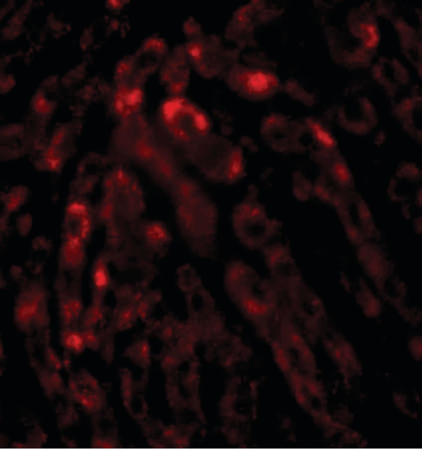 IHC-plus™ ACOT13 / THEM2 Antibody