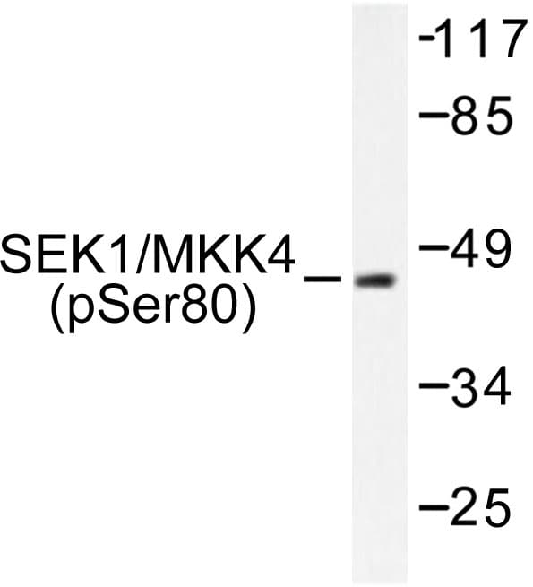 MAP2K4 / MKK4 Antibody (phospho-Ser80)