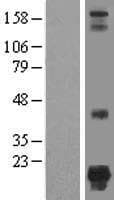 Human NSUN5P2 Protein (Over-Expression Lysate Myc-DDK (Flag))