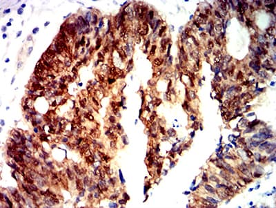CTNNB1 / Beta Catenin Antibody (clone 7C5A2)