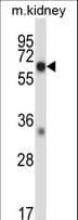 MAP3K2 / MEKK2 Antibody (aa14-43)