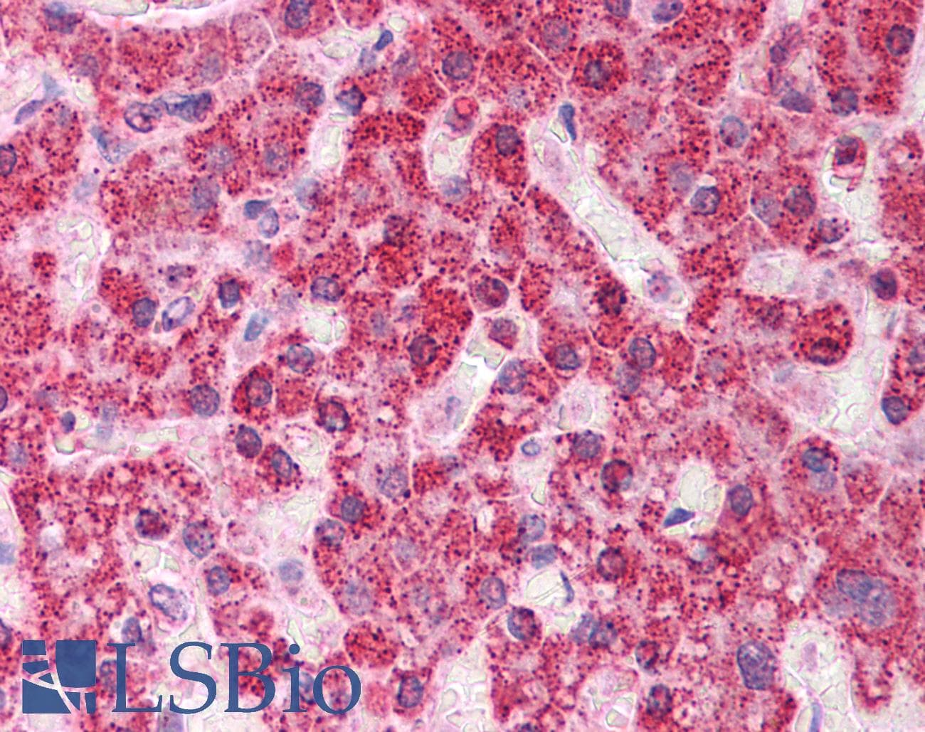 Rhodanese / TST Antibody (aa101-150)