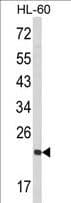 RAN Antibody (aa12-39)