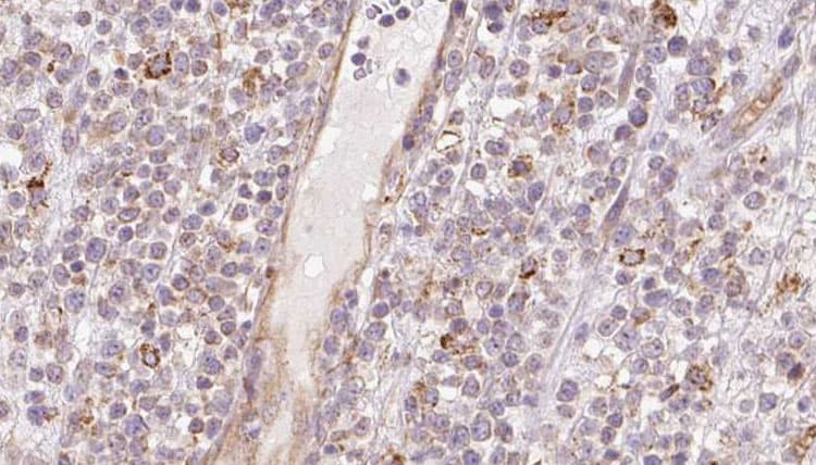 CCBL1 Antibody