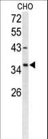 IHC-plus™ Polyclonal Rabbit anti-Human FOXL1 Antibody (aa94-119, IHC, WB)