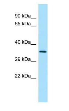 Polyclonal Rabbit anti-Human SPG21 / MAST Antibody (C-Terminus, IHC, WB)