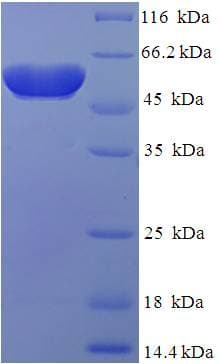 Human ATOH1 / MATH-1 Protein (Recombinant His-SUMO)