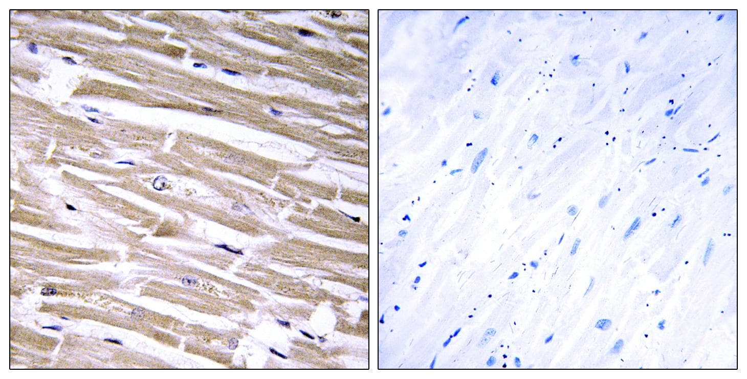 GLCT2 / B3GALT2 Antibody