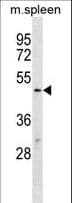 Polyclonal Rabbit anti-Human TBX20 Antibody (aa308-335, WB)