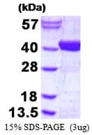 Human ADPRHL2 Protein (Recombinant His)