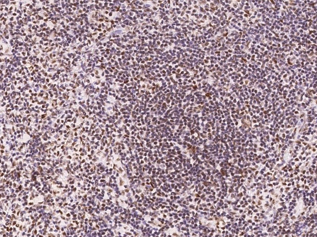 CCNT1 / Cyclin T1 Antibody