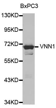 IHC-plus™ Polyclonal Rabbit anti-Human VNN1 Antibody (IHC, WB)