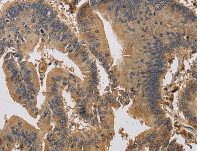Polyclonal Rabbit anti-Human KIF22 / OBP Antibody (IHC, WB)