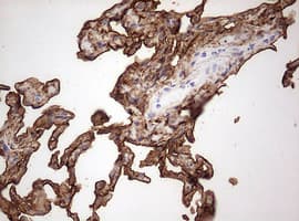 Monoclonal Mouse anti-Human KRT7 / CK7 / Cytokeratin 7 Antibody (clone OTI1B3, IHC, WB)