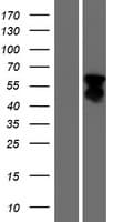 FOXL2 Protein (Over-Expression Lysate Myc-DDK (Flag))